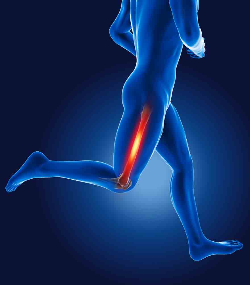 managing it band friction syndrome pain management