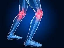 joint replacement academy